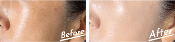 Before After