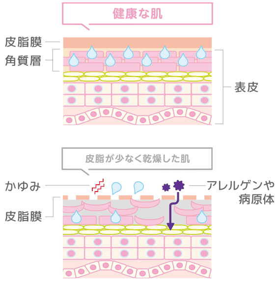 健康な肌と皮脂が少なく乾燥した肌