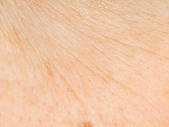 シワが目立つ肌の写真