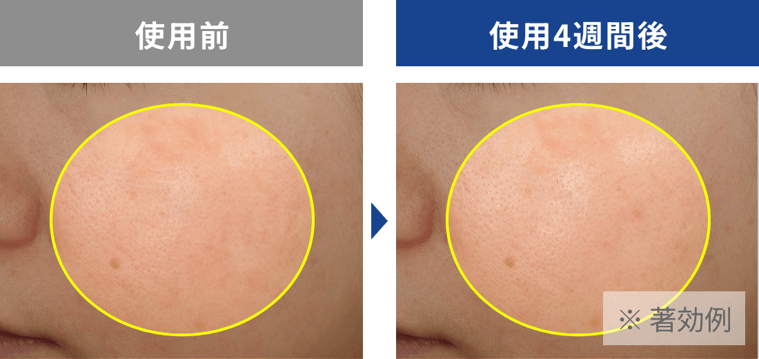 頬