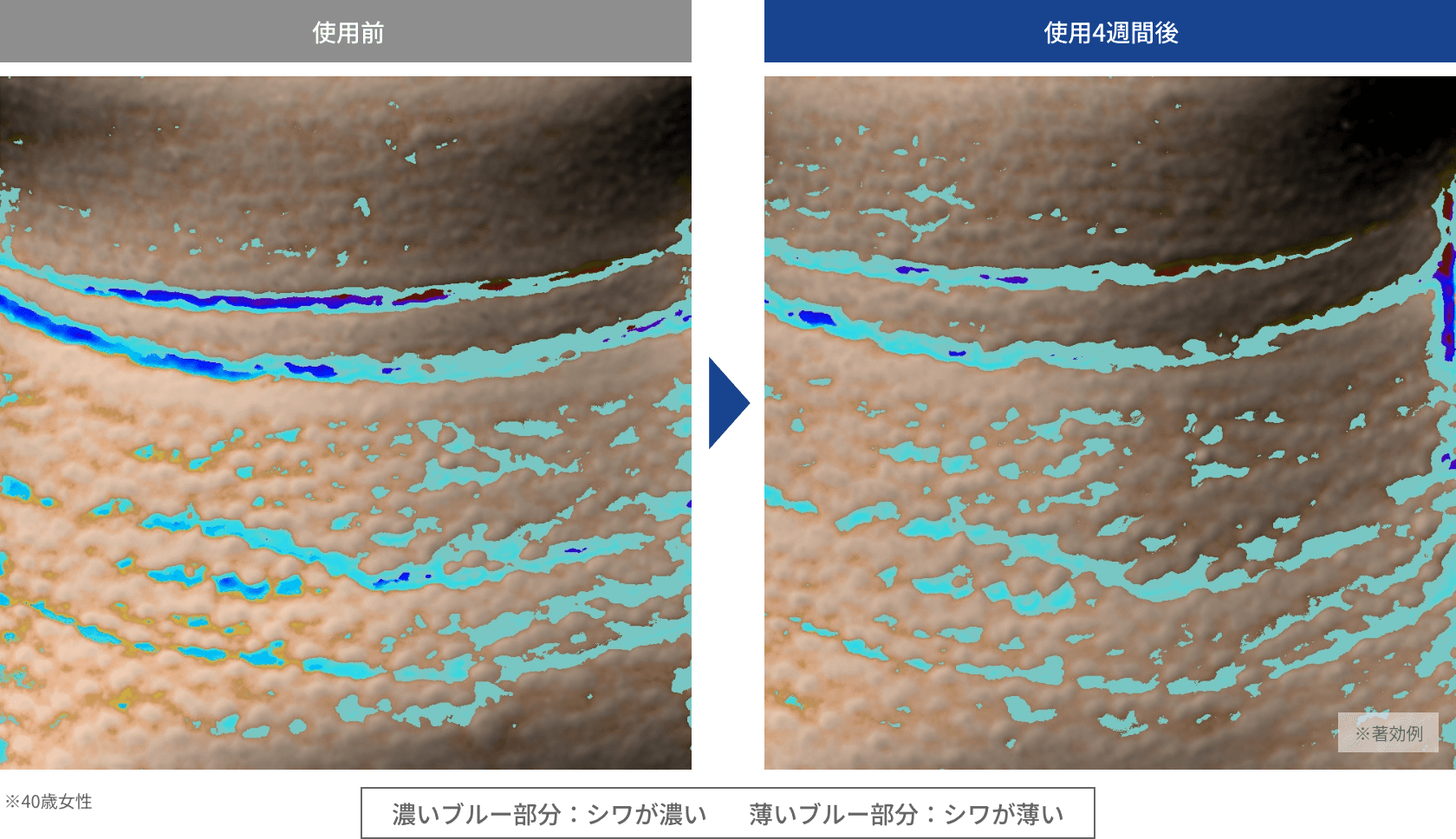 目もと、首もと